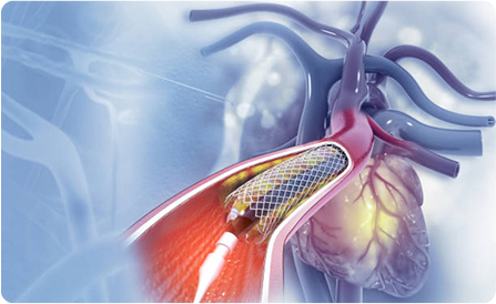 Interventional Procedures
